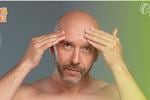 ¿Estás calvo? Los mejores tratamientos para la alopecia, según los dermatólogos