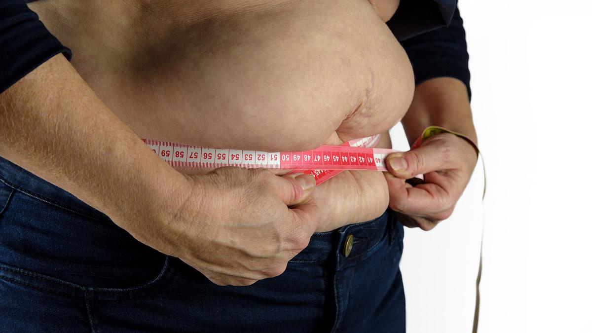 Obesidad. | Como cualquier otro medicamento, Ozempic no está exento de efectos adversos. (Pixabay)