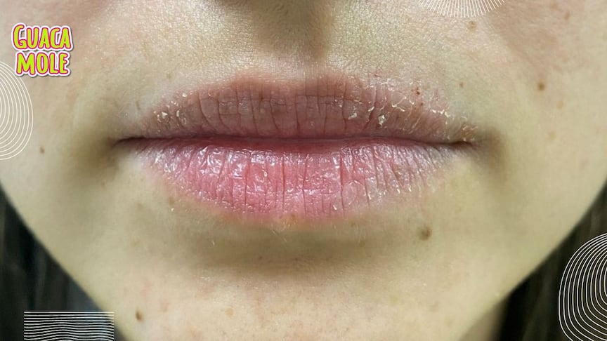 Quítate este problema incómodo en tus labios y haz que queden suaves con este tip. (Especial: Dermamurcia).